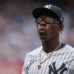 Why does Yankees’ infielder Jazz Chisholm require surgery?