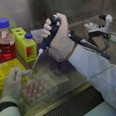 Viruela del mono en Querétaro: Cuántos casos suma y qué han dicho las autoridades