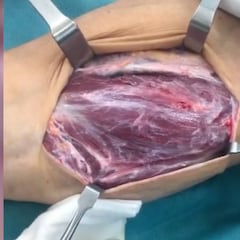 Crutchlow paraliza Instagram con un vídeo de sus músculos moviéndose en plena operación