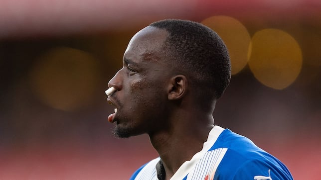 Moussa Diarra tiene la nariz rota
