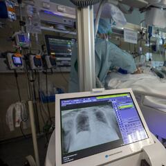 La variante XE desarrolla dos síntomas que no tiene Ómicron