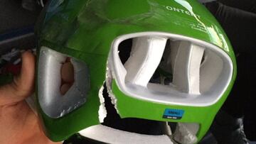 El ciclista italiano del Cannondale-Drapac Davide Formolo muestra su casco partido tras una ca&iacute;da en la Par&iacute;s-Niza.