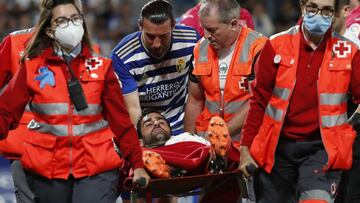 Riesgo da el susto: hospitalizado tras un pelotazo en la cara