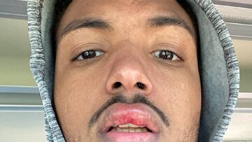 Edipo denuncia un nuevo episodio racista en Tercera División.