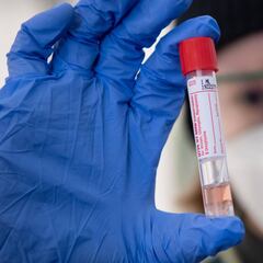 Coronavirus: Is a second wave of infection possible?