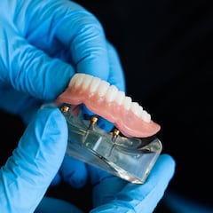 Un turista británico recupera su dentadura postiza perdida en España 11 años después