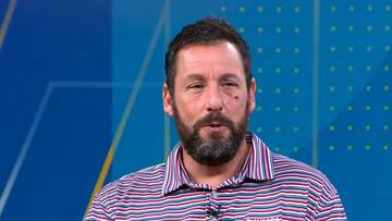 Adam Sandler aparece con un ojo morado por un “accidente en la cama”: “No es gracioso”. Foto vía: Good Morning America.