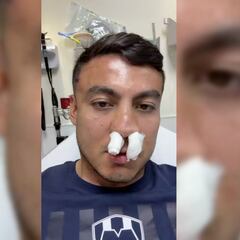 Vídeo: Así quedó Luis Cárdenas tras el golpe que recibió por parte de Diego Medina