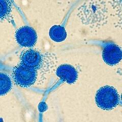 Alerta en Europa por un hongo potencialmente mortal: puede afectar a millones de personas