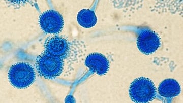 Alerta en Europa por un hongo potencialmente mortal: puede afectar a millones de personas