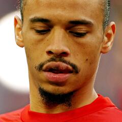 This is how Sané's lip was left after being punched by Mané