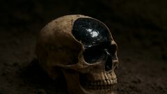 Experts baffled as scientists discover a man with a brain made of glass