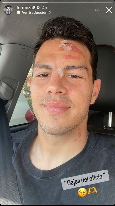 Muestran cómo le quedó el rostro a jugador de Palestino tras patada de Jeyson Rojas