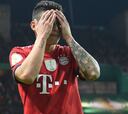 El error de James que le costó el primer gol al Bayern