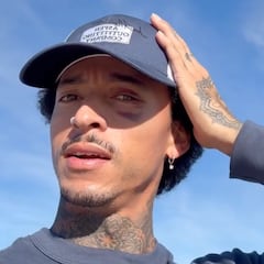 Nyjah Huston: “Me he golpeado la cabeza desde niño… no hagáis eso, poneros casco”