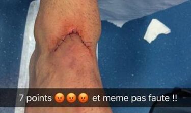 Cabella denuncia que tuvo que recibir 7 puntos y "¡no pitó falta!"