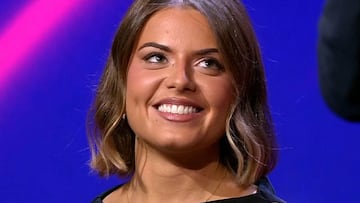 Qué es la alopecia androgénica, el tipo de calvicie que padece Elsa Mateos, de ‘Gran Hermano’