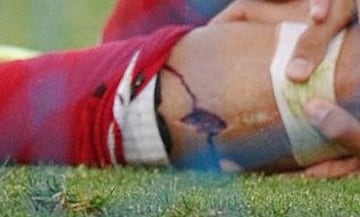 El delantero del Atlético de Madrid Diego Costa, se golpea la pierna con el poste tras marcar el segundo gol ante el Getafe en el partido de Liga en Primera División que disputan esta tarde en el Coliseo Alfonso Pérez.