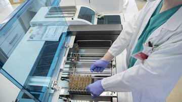 Máquina para detección de anticuerpos por CLIA
GOBIERNO DE NAVARRA
15/06/2020