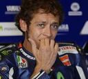 Rossi dice que tiene su dedo como un "descapotable"