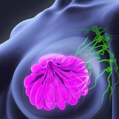 Cómo una IA es capaz de detectar el cáncer de mama tan bien como un radiólogo