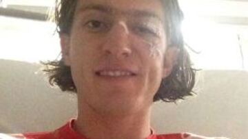 Filipe Luis, hospitalizado con un traumatismo craneoncefálico