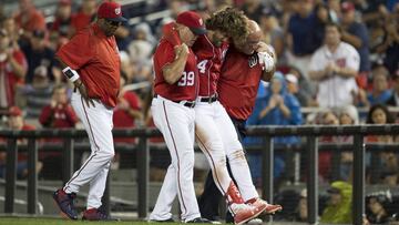 Bryce Harper ha evitado un resultado catastr&oacute;fico despu&eacute;s de su espeluznante lesi&oacute;n el pasado viernes.