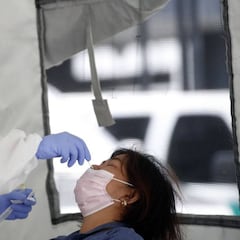 Coronavirus en USA: ¿Son la diarrea y los vómitos un síntoma de COVID-19?