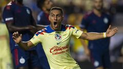 ¡Otra baja para el América! Sebastián Cáceres hospitalizado tras lesión en el partido contra Puebla