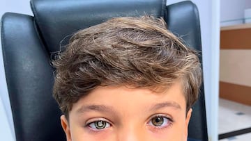 Anthony Milani, con su prótesis ocular con el escudo del Santos