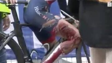La ciclista hero¨ªna: esta herida no le impidi¨® acabar la carrera
