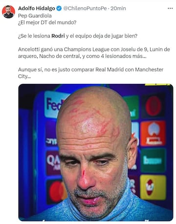 Los memes no dan tregua a Guardiola