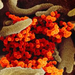 La cepa del COVID-19 que contagió a Italia: vino de Alemania y es más contagiosa