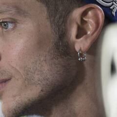 Valentino Rossi resting after surgery on broken leg
