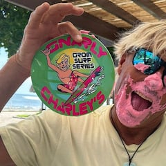 Gnarly Charley, mordido en la capital mundial de los ataques de tiburón