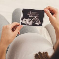 Ley para el aborto legal: qué es el Plan de los 1.000 días