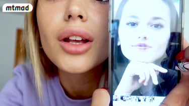 El antes y el después de Gal·la tras sus retoques estéticos