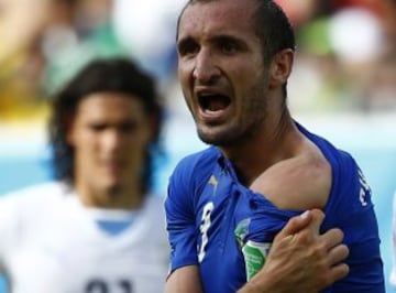 Giorgio Chiellini muestra las marcas del mordisco de Luis Suárez.