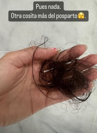 Cristina Pedroche muestra una preocupante secuela del postparto