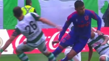 Terrible lesión en Chile: ¡duele sólo con ver la escena!