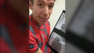 Rigo y su nuevo juguete tras la cirugía