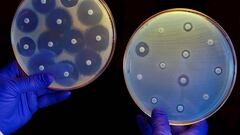 El aviso de la OMS sobre la ‘pandemia silenciosa’: así afecta el uso excesivo de antibióticos