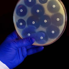 El aviso de la OMS sobre la ‘pandemia silenciosa’: así afecta el uso excesivo de antibióticos