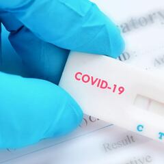 Record de contagios en Argentina: dónde conseguir los autotest y cómo realizarlos