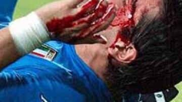 <b>GOLPE.</b> Durante el partido contra Corea del Sur, Coco sufrió un percance.