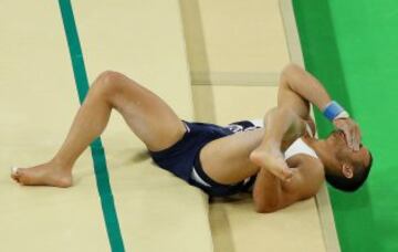 El gimnasta francés se fracturó la tibia de su pierna izquierda tras un mal salto. Sus compañeros no lo pedían creer. La peor imagen de Río 2016.