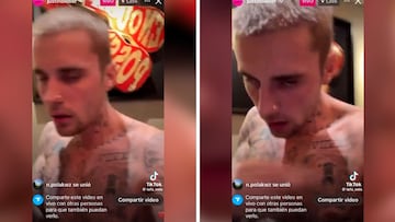 Saltan las alarmas con el estado de Justin Bieber en su último vídeo en redes sociales