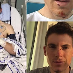 Ben Swift recibe el alta médica tras su lesión en el bazo