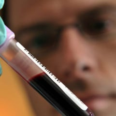 La AMA suspende el laboratorio antidopaje de Madrid