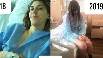 La jugadora de balonmano de Croacia Camila Micijevic, durante su recuperaci&oacute;n tras dos lesiones de rodilla en el hospital.